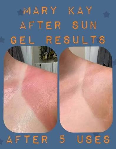 After Sun Rescue Gel