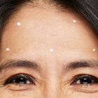 Wrinkle Limiter Clinical Solutions® Dynamic Wrinkle Limiter™
